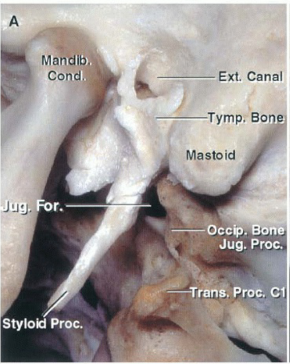 Mandib. Cond. Stylod Proc. Ext. Canal Tymp, Bon Masło id ccW bone Jug. Proc. Proc. Cl 