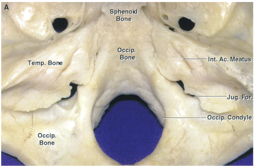 Sphenod Bone Occip. Bone Temp. Bore Occip. Bone Int. Ac. Meatu Jug. Occ p. Candy! 