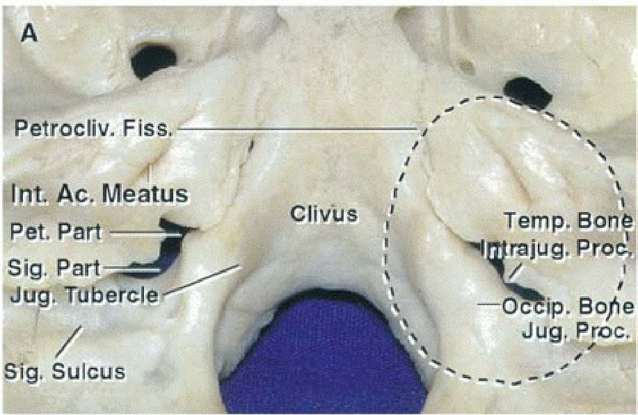 Posterior superior view of the jugular foramen