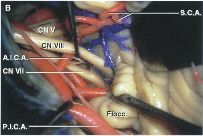 Close-up of a human body AI-generated content may be incorrect.