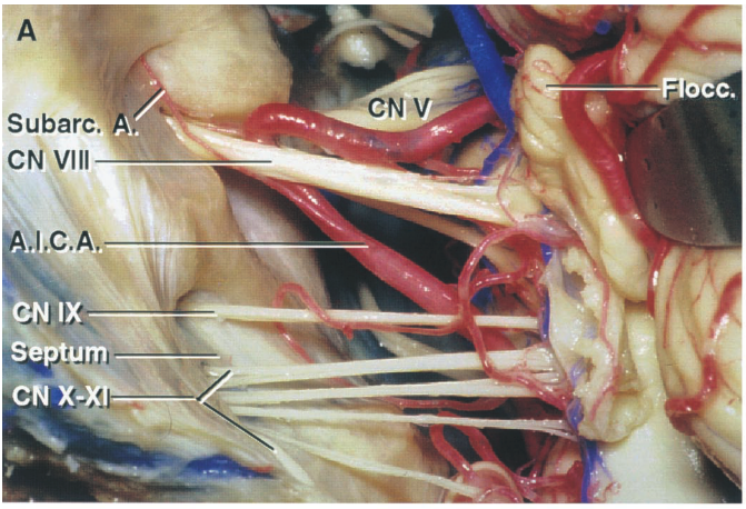 Subarc. CN VIII II.c.A. 