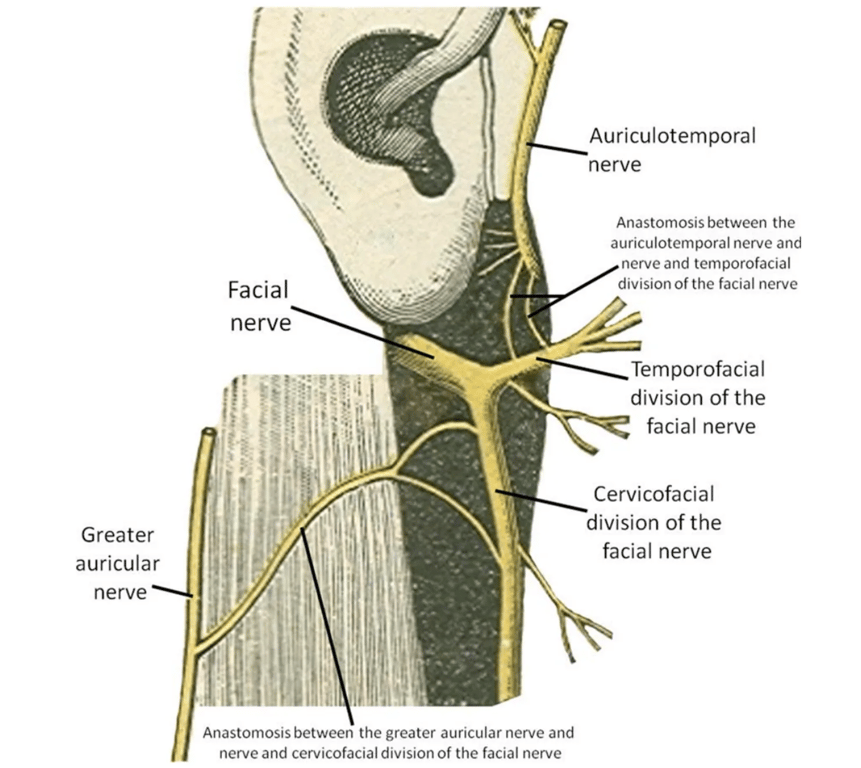Anastomosis of the auriculotemporal nerve with the temporofacial division of the facial nerve and anastomosis of the greater auricular nerve with the cervicofacial division of the facial nerve at the parotid and peri-parotid regions.