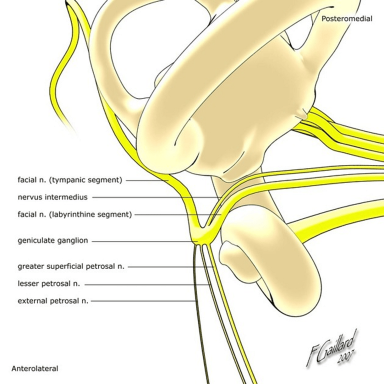 This image is a bit wrong the lesser petrosal nerve does not arise from the geniculate ganglion but it comes from the tympanic plexus. The geniculate ganglion has a connection with the tympanic plexus via the geniculotympanic nerve