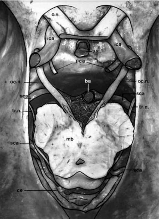 Superior view of the tentorial notch displaying its neurovascular relationships. 
Basilar artery (ba); cerebellum (ce); internal carotid artery (ica); midbrain (mb); oculomotor nerve (oc.n.); optic nerve (o.n.); pituitary stalk (ps); posterior communicating artery (pca); superior cerebellar artery (sca); and trochlear nerve (tr.n.).
