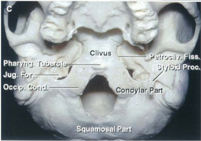 Clivus Jug.! Condylar Part 