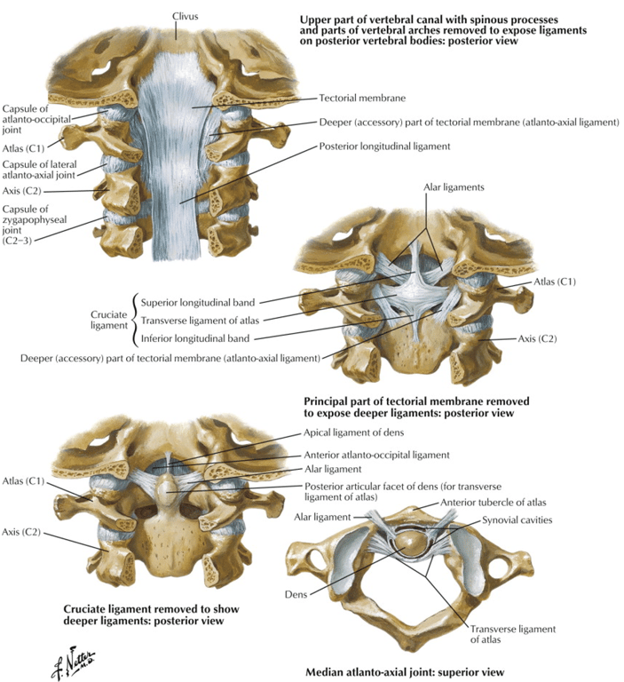 Capsule of atlanto-occipital joint Atlas (Cl) Capsule oi lateral atlanto-axial joint Capsule of zygapophyseal joint (C2-3) Clivus Superior longitudinal band Cruciate Transverse ligament Of atlas ligament Inferior longitudinal band Upper part Of vertebral canal with spinous processes and parts of vertebral arches removed to expose ligaments on posterior vertebral bodies: posterior view Tectorial membrane Deeper (accessory) part of tectorial membrane (atlanto-axial ligament) Posterior longitudinal ligament Alar ligaments Atlas Axis (C2) Deeper (accessory) part Of tectorial membrane (atlanto-axial ligament) Principal part Of tectorial membrane removed to expose deeper ligaments: posterior view Apical ligament Of dens Anterior atlantooccipital ligament Alar ligament Posterior articular facet of dens (for transverse Atlas Axis (C2) ligament Of atlas) Alar ligament Dens Cruciate ligament removed to show deeper ligaments: posterior view Anterior tubercle oi atlas Synovial cavities Transverse ligament of atlas Median atlanto-axial joint: superior view 