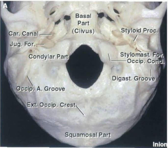 'o Basal Part Styloid Proc. Car. Canal —O (Clivus) Jug. Condylar Part Occip; A. Groove Ext. occip. Crest Stylomast. Occip. Co Digast. Groove Squamosal Part Inio 