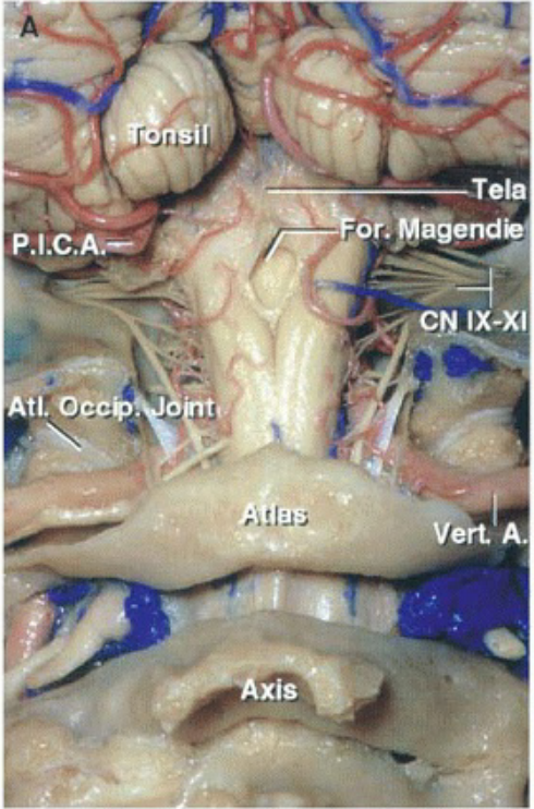 P.I.C.A>'" C IX-XI Atl.oc Vert A. xis 