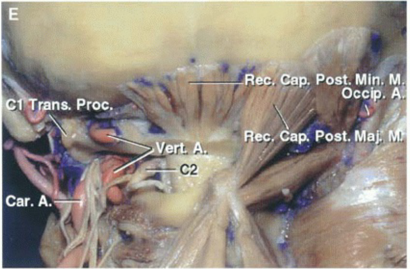 в. Ргос,. вс. Сар. Post.Mi . М Осср. А. ' [Сар: Post. Мае 