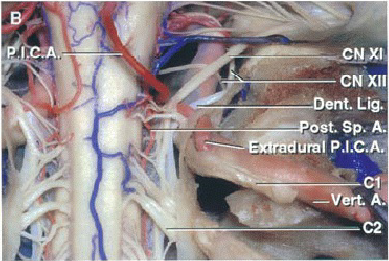 Close-up of a human body anatomy AI-generated content may be incorrect.