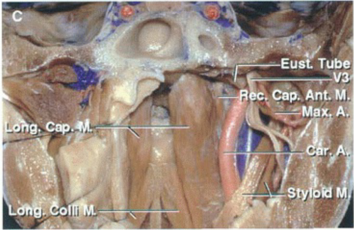 из ТиЬе Сар. Ant. М. '2 -ма А. sty И 