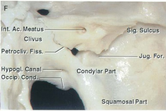 Int. Ac. Meatus Clivus Sig. Sulcus Petrocliv. Fiss. —7 Jug. For Hypogl. Canal Condylar Part OccV. Cond. Squamosal Part 