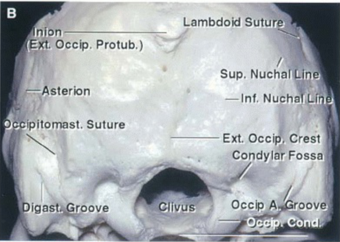 nion ('Ext. occip. —:-Asterbn Protub.) Lambdoid Suture Sup, NuchaILine ipitomast. Suture Digast.goove Clivus —Inf. Nucha Li Ext. Occi . Crest Condylar Fossa Occip A oove 