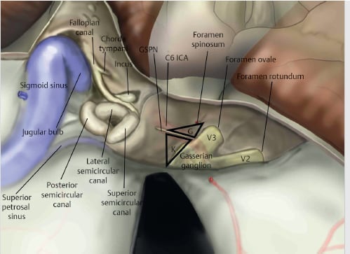 Foramen Co ICA sin Jugular rotundUm ratera' Semicircu canal Superior petrosa ' sinus Posterior semicircular canal semicil"ll Canal 