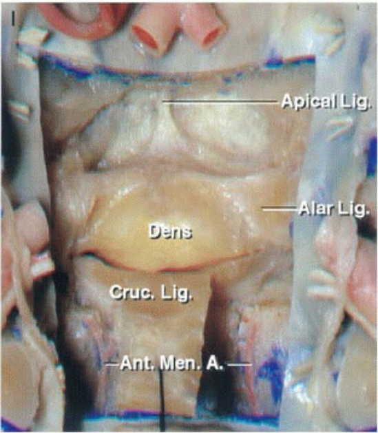 Crue• Lig• •誹 … Men A. 
