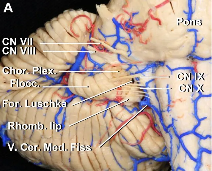Anterior view of the petrosal surface of the cerebellum and the brainstem. 
