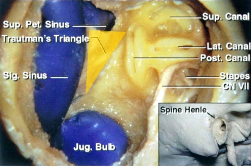 Sgp, pet Shus Tæ!nfin's Triangle—x Jug. Bulb Canal CiJU Spino Henle 
