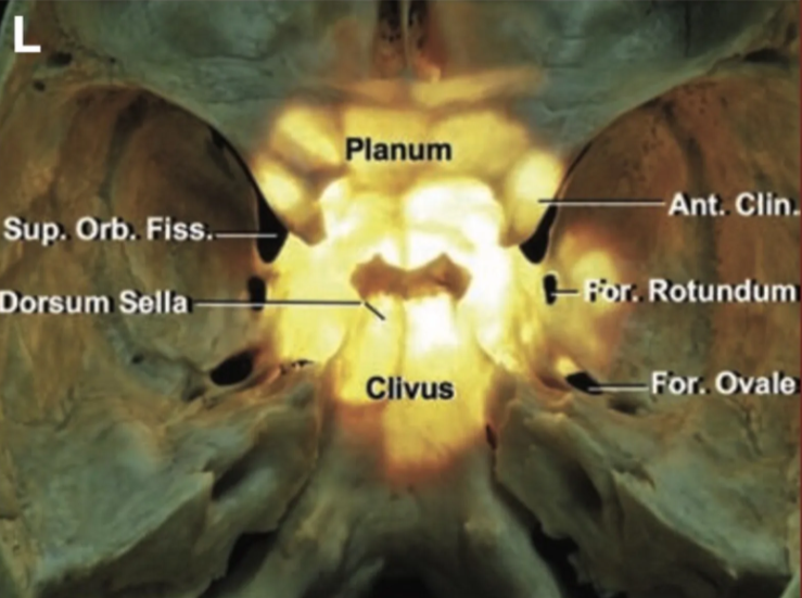 Superior view of the sphenoid bone. 