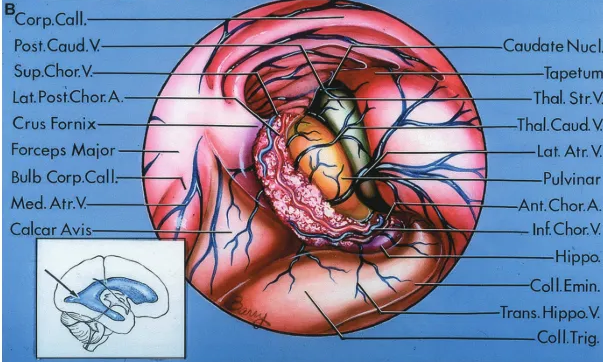 A C Bcorpcall. Coll-Emin. Chor. Plex. Cm Nucl.T• 。 一 一 Lat-Post.Chor.A. Tapetu Med. Atr.V Caudate Nucl. LatPost.Chor.A Body Fornix Corp.Call. Bulb Corp.Call. Forceps M 0 「 Crus Fornix Lat.PostChor.A. Tl 一 45 V. Sup.Chor.V Post.Caud.V ColumnFornix Fbst.Chor.A. SupChor.V AntCoud.V Ant.Sept-V Trans. Hi For.Monro Tra , 叾 Ant.TiY11.V AmygdN Thol.Cau Ant-Chor Rostrum Ant-Chor udateN 1 一 一 St ChorF Amygd Thala Lat. At lnEVen oll.E Tapet Fimb 