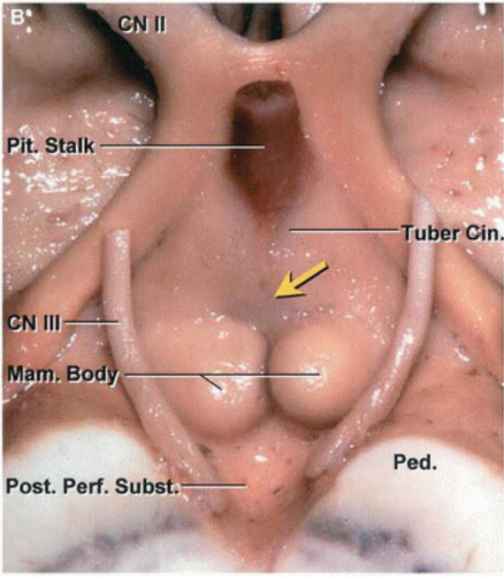 it. Stalk N Ill, %am. Bod Post. Perf. Subst. u t*rCin 