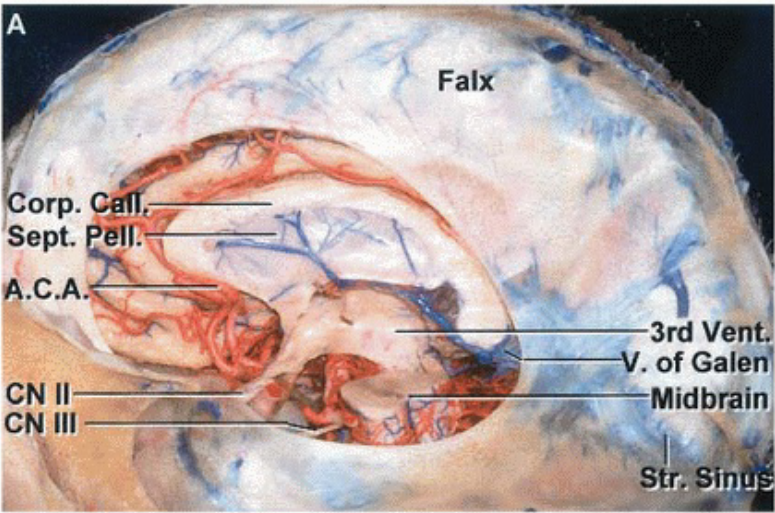 'IIS eleo JO en put Ill NO Il NO •ßøs •d10 