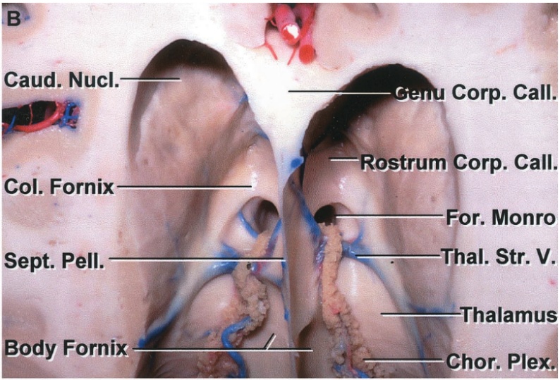 Caud. Nucl. Col. Fornix sept. Pen. Ody Fornix Corp . Cali ŠRbstrum orp. Cali, r. Monro Tlh al. Str. V' Thalamu hor. Ple 