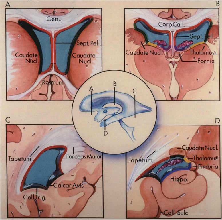 Caudate MCI. Tapetym Col rig. Genu Sept. Pell. Caudate Nucl. Forceps Maio Calcar Ca Corp.Call. ate Nuc . Tapetum Sept. Il halam si Forni ateNucl. Thalamus .Hi PO. ulc. 