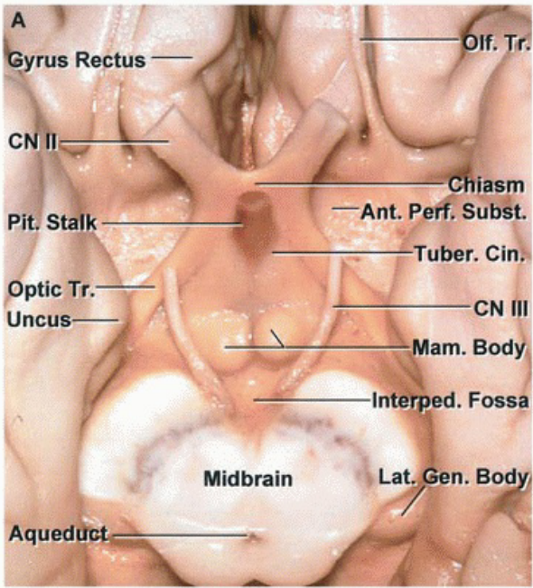 eyrus Rectus — c Pit stalk pptic Tr. Uncus— Aqued iiasm —Ant. peri Tuber. Ci CN am. Bod —Ci—lnterped. Fos Midbrain Lat. n. Bod 