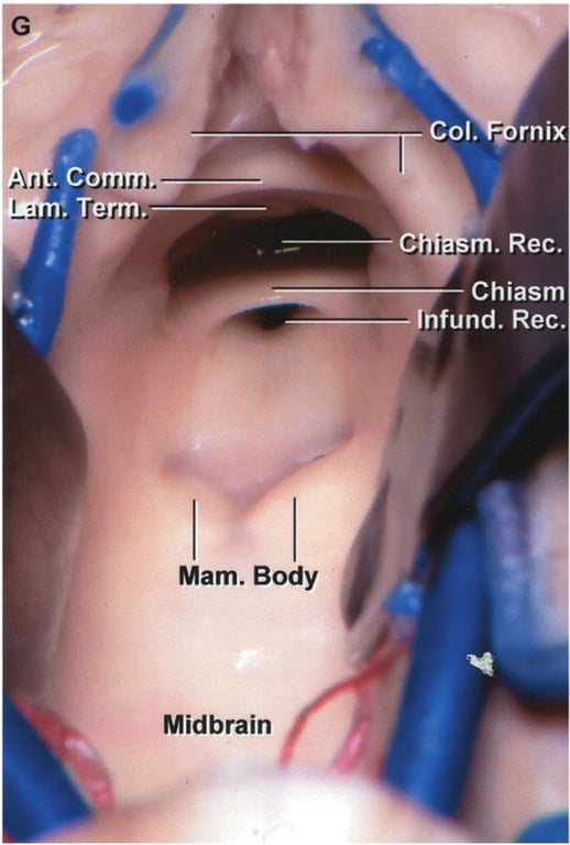 C rnix m. Rec. Chiasm Infund. Rec. Mam. Body Midbrain 