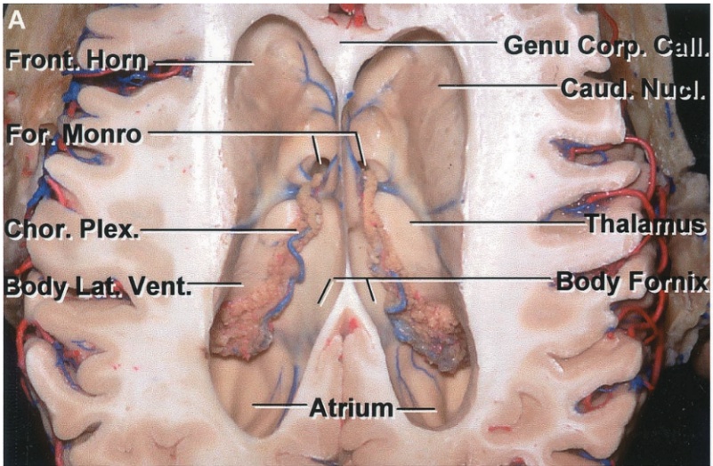 roh o Hor onro Genu C Cau hal Call. or. Plex. y*ÔVent. Atr)um 