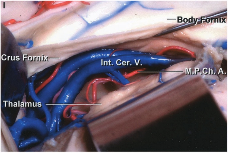 Crus —Bod orní Int. Cer. V. ThalÔ'nus 