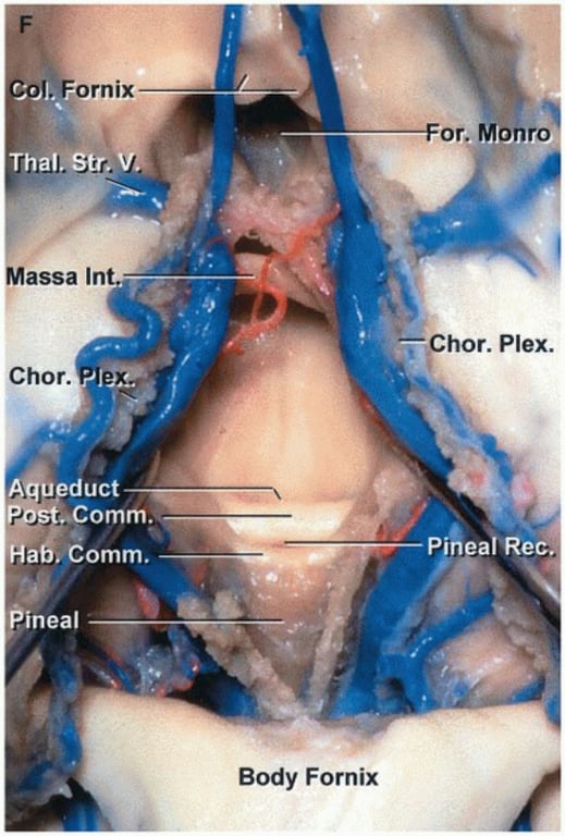 Thal.str. Massa Int Chor. A duct p ..Comm. Ha', Comm. ineal or. Monr • -;-ßhor. Plex. Pi al R Body Fornix 