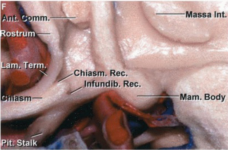 mm. amJerm. asm— it? Stalk Massa Int; Chiasm. Rec. nfundib. Rec. Mam. Body 