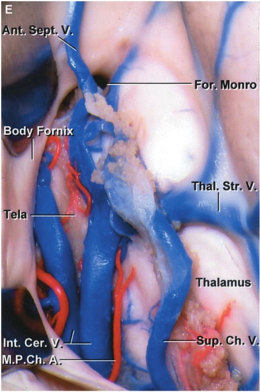 Ånt. S Body ela Int. Cer. M.P.Ch:• Fo Monro mix T al. Str. Thalamus Sup„Ch. 