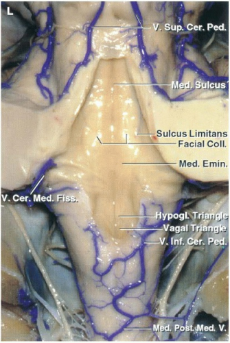 . ped, Icus Sulcus Limitans Facial col[ Med. Emin. agal T 