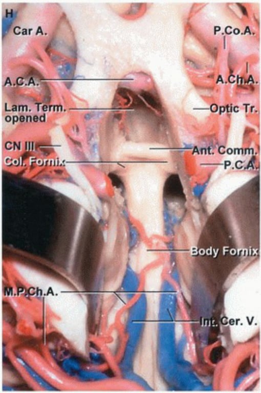Close-up of a human body anatomy AI-generated content may be incorrect.