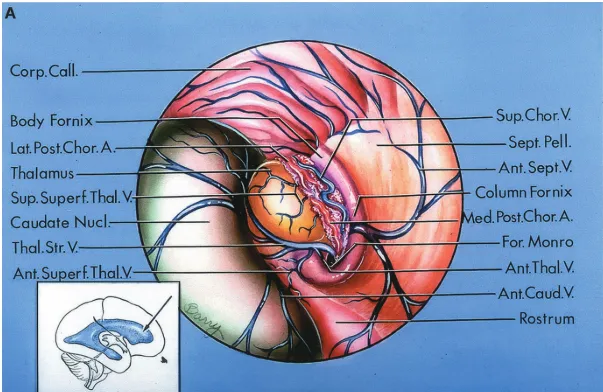 A C Bcorpcall. Coll-Emin. Chor. Plex. Cm Nucl.T• 。 一 一 Lat-Post.Chor.A. Tapetu Med. Atr.V Caudate Nucl. LatPost.Chor.A Body Fornix Corp.Call. Bulb Corp.Call. Forceps M 0 「 Crus Fornix Lat.PostChor.A. Tl 一 45 V. Sup.Chor.V Post.Caud.V ColumnFornix Fbst.Chor.A. SupChor.V AntCoud.V Ant.Sept-V Trans. Hi For.Monro Tra , 叾 Ant.TiY11.V AmygdN Thol.Cau Ant-Chor Rostrum Ant-Chor udateN 1 一 一 St ChorF Amygd Thala Lat. At lnEVen oll.E Tapet Fimb 