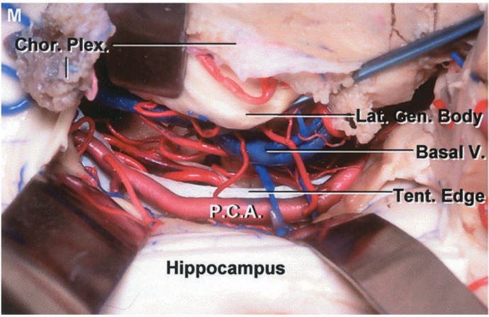 •t%Jex Basal V Ten dg Hippocampus 