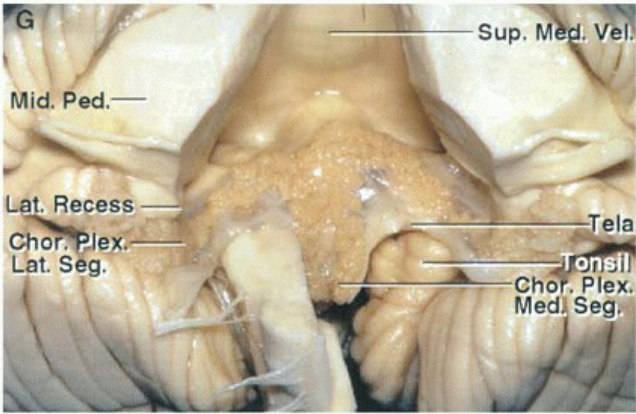 Mid. Ped.— t. Recess I-at. S". • Tela Cho . Plex. Med seg 