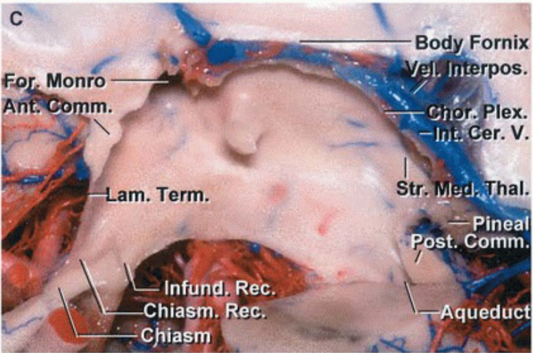 EO Monro -„Lam. Term. hiasm. ec• Chia4b Bod Fornix Inr,: . lex. str. hal. —Pineal queduct 