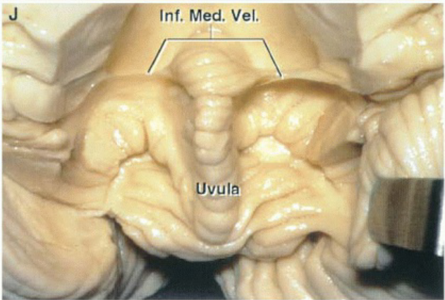 Close-up of a human body AI-generated content may be incorrect.