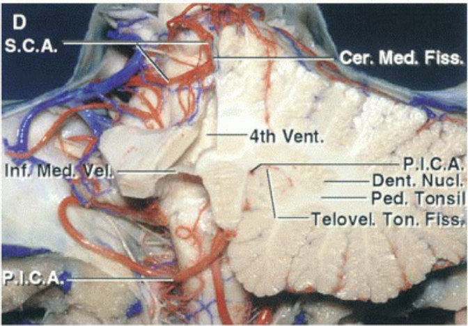 S.C.A. Cer. Fîss. • —4th Vent. p.l.C. Dent. Nucl.4 Ped. Țonsi —Telovel. Ton. F 