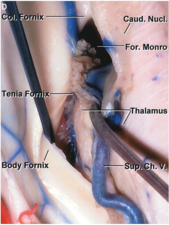 C ornix Caud. Nuc For. Monr Thalamus Tenia F dy F rnix 