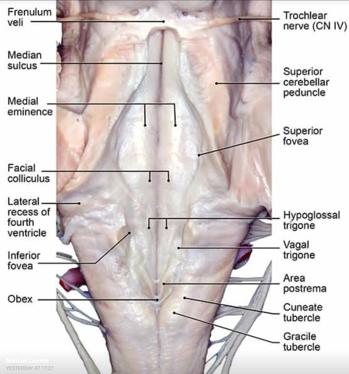 Frenulum veli Median sulcus Medial eminence Facial Lateral recess Of fourth ventricle Inferior fovea Obex YESTERDAY AT 17:27 Trochlear nerve (CN IV) Superior cerebellar peduncle Superior fovea Hypoglossal trigone Vagal trigone Area postrema Cuneate tubercle Gracile tubercle 
