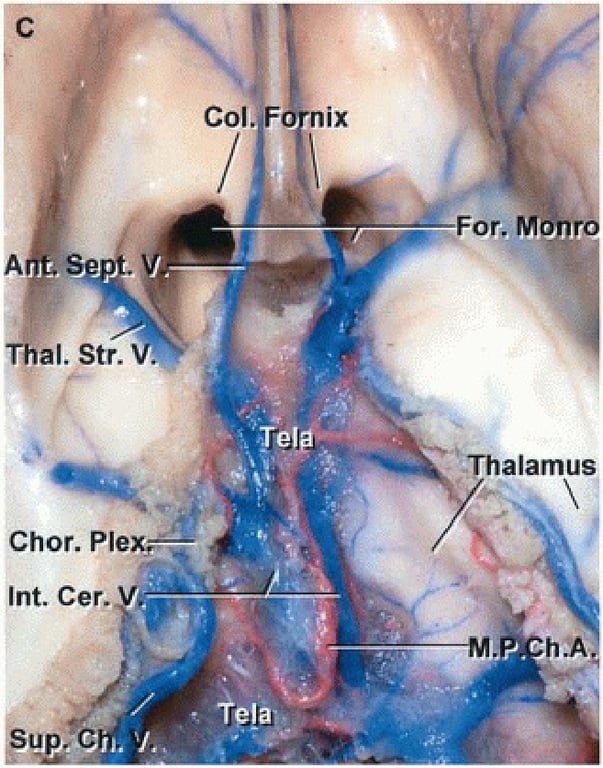 Col. Thal. Str. nix For. M -Thalamus Chor. Plev Int. Cer. 