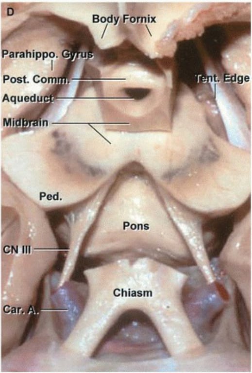 use! 110 NO suod •pad npønbv WOO •JSOd •odd!qued X!tuo {pog 