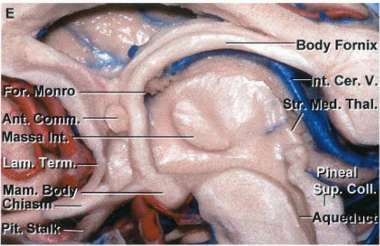 ro Ma Mam. Body Fomix t. Cer. V. d. Thal. .-coll. qu 