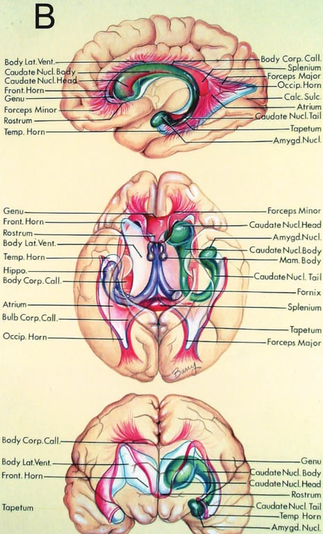 Top, view through medial surface of the hemisphere;
Middle, view through inferior surface of the hemisphere;
Bottom, view through the anterior surface of the hemisphere.