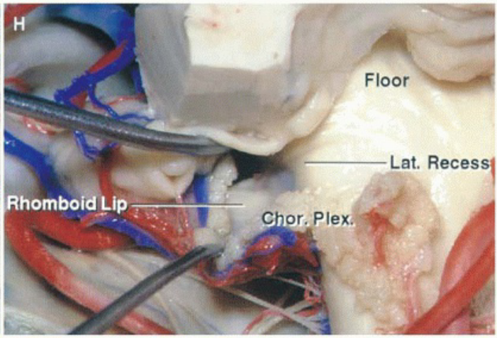 ombo up Floor Lat. Reces C or. Plex. 