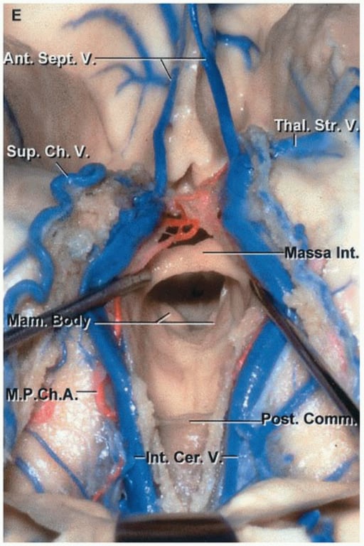 Close-up of a human body anatomy AI-generated content may be incorrect.
